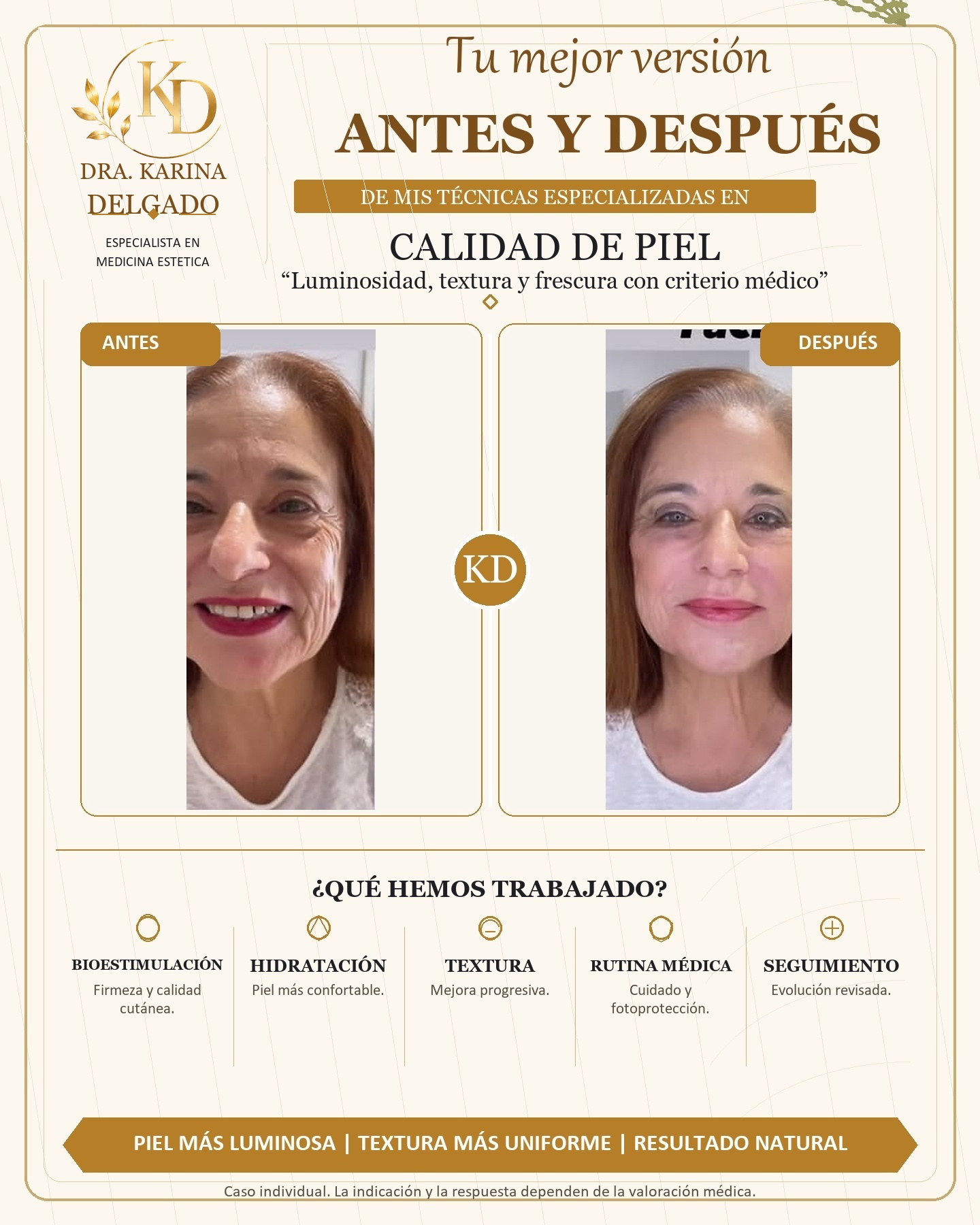 Caso real antes y despues de calidad facial